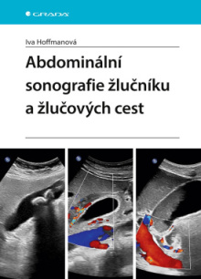 Abdominální sonografie žlučníku a žlučových cest